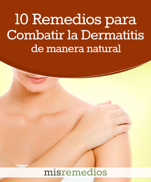 10 Remedios para Combatir la Dermatitis de Manera Natural