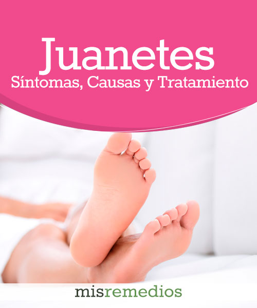 Juanetes